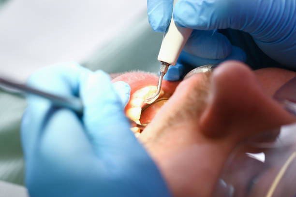 Best Emergency Dental Extractions in Elba, AL