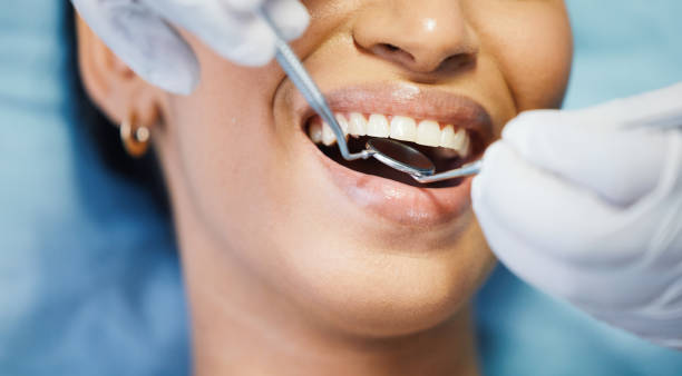 Best Emergency Dentist for Lost Fillings or Crowns in Elba, AL