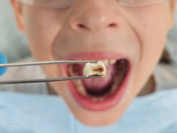 Best Emergency Dentist for Knocked-Out Tooth in Elba, AL