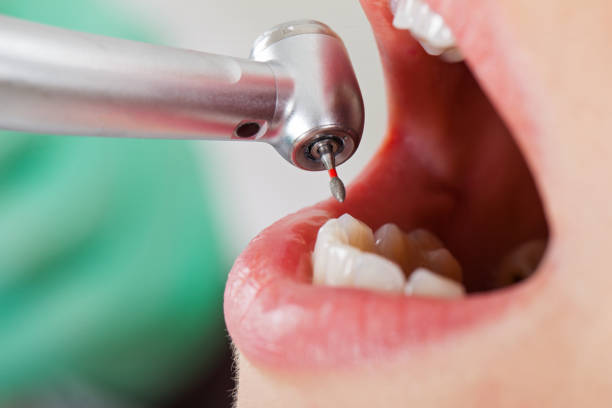 Best Emergency Dental Care for Abscessed Tooth in Elba, AL
